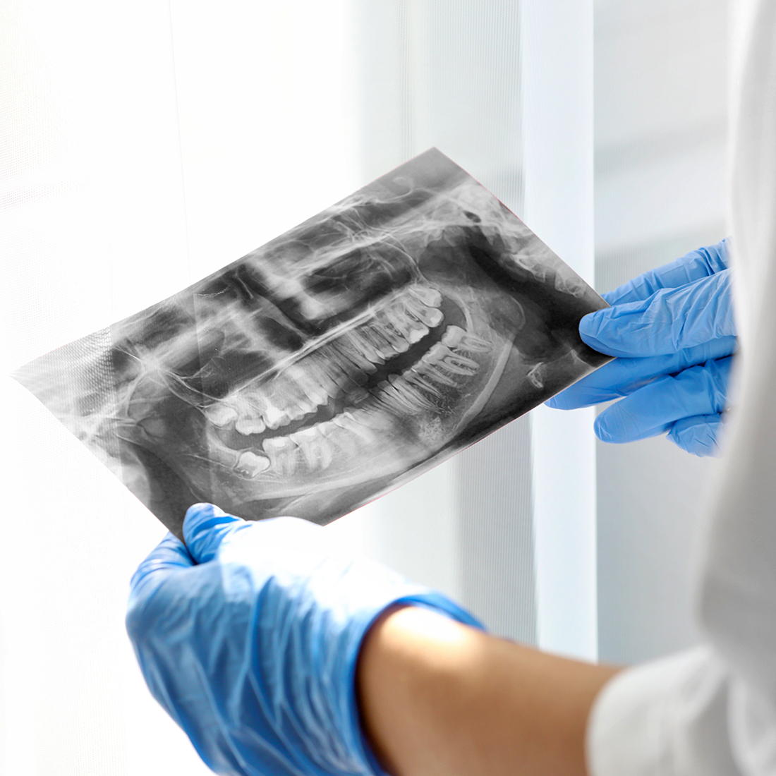 Cirugía Oral en Canet de Mar Clínica Dental