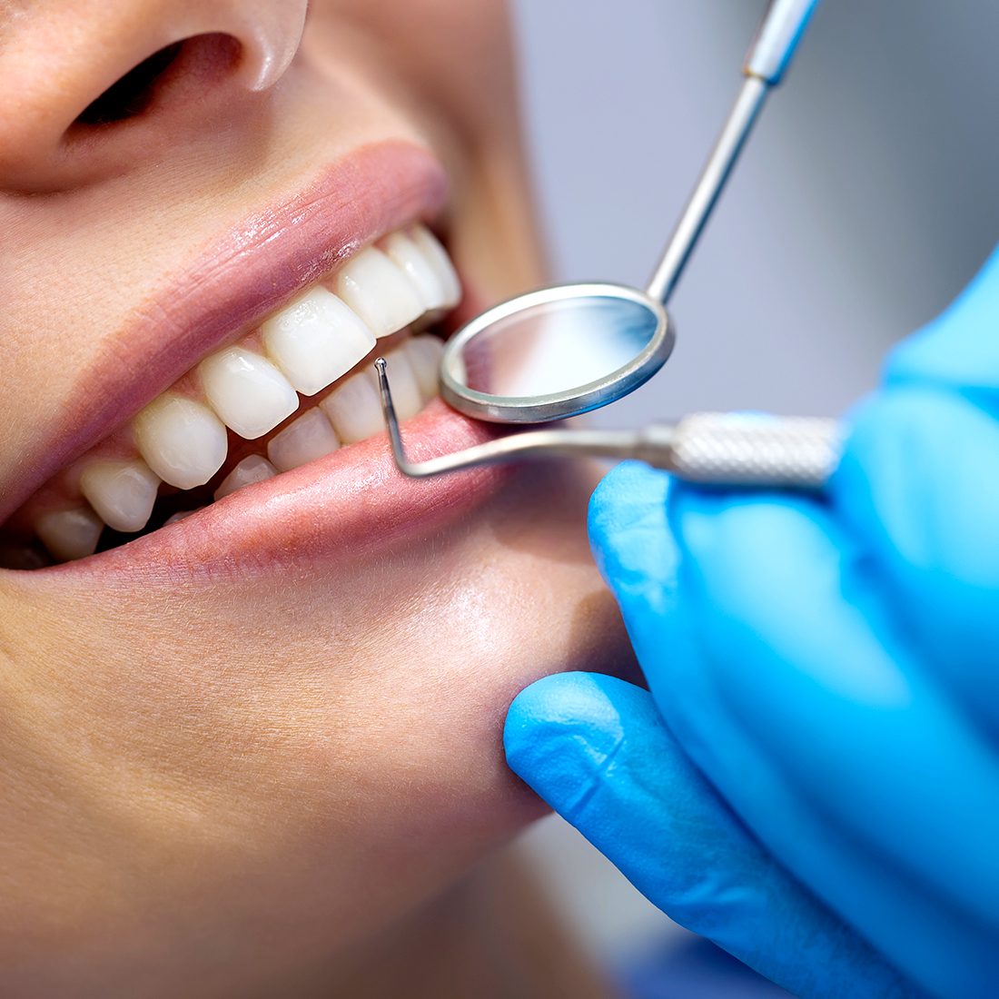 odontologia en clinica dental canet de mar