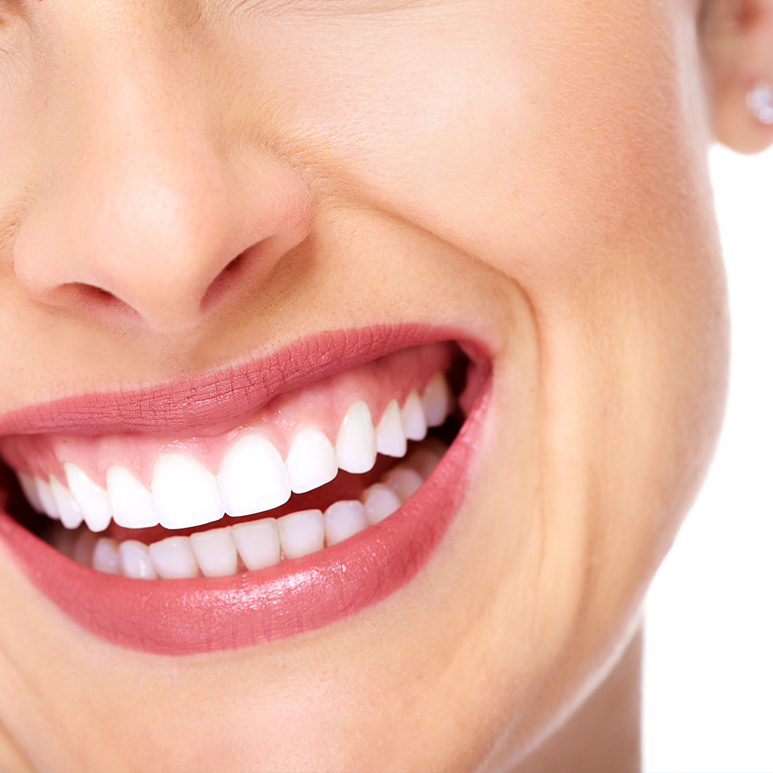 odontologia estetica en canet de mar