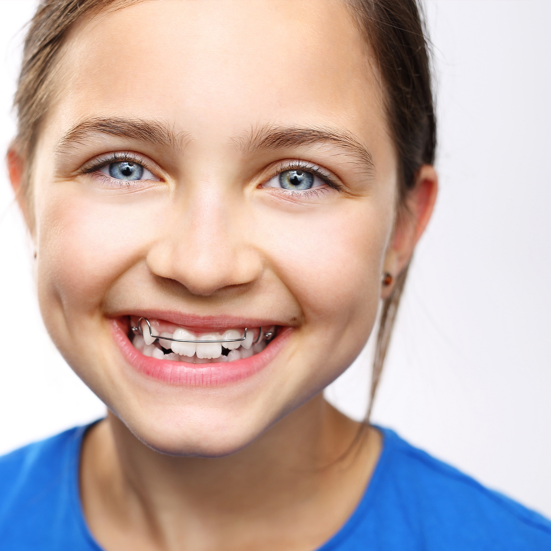 ortodoncia en clinica dental canet de mar
